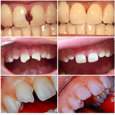 Rekomendasi Klinik Gigi Terdekat  Cipayung Depok
