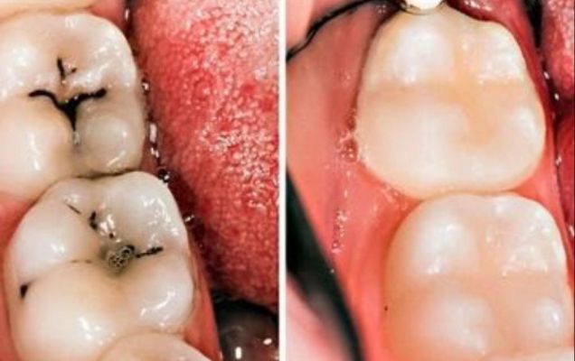 Klinik Tempat Pembersihan Karang Gigi Harga Terbaik  Bojongsari Depok