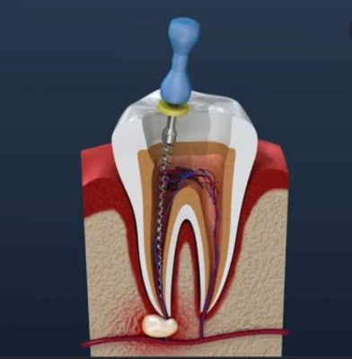 Rekomendasi Klinik Dentist Terdekat  Sukmajaya Depok